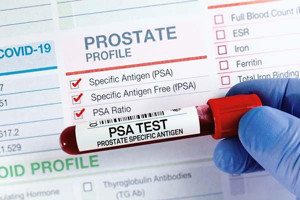 Symptoms of early-stage prostate cancer