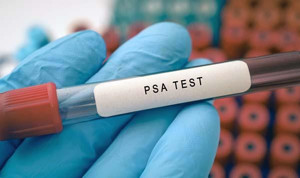 What is a PSA test and how is it used?