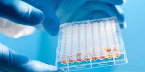 UNGA81: Robust laboratory systems key to preventing, ...