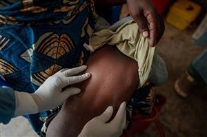 Statement of the WHO Global Advisory Committee on Vaccine Safety (GACVS) on the safety of the mpox vaccines for use in high-risk groups