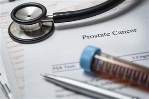 New research shows little risk of infection from prostate biopsies